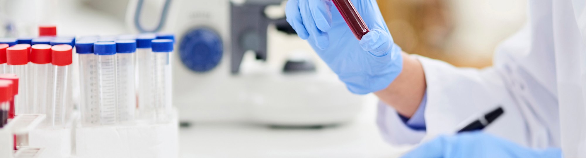 Technicial holding a vial of blood in a lab