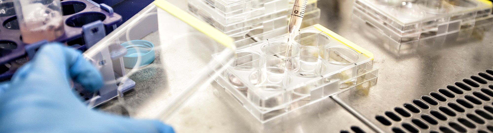 Closeup of gloved hand working with research samples